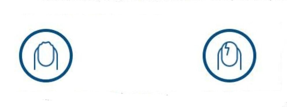 Verformung vun den Nägel duerch Pilzinfektioun